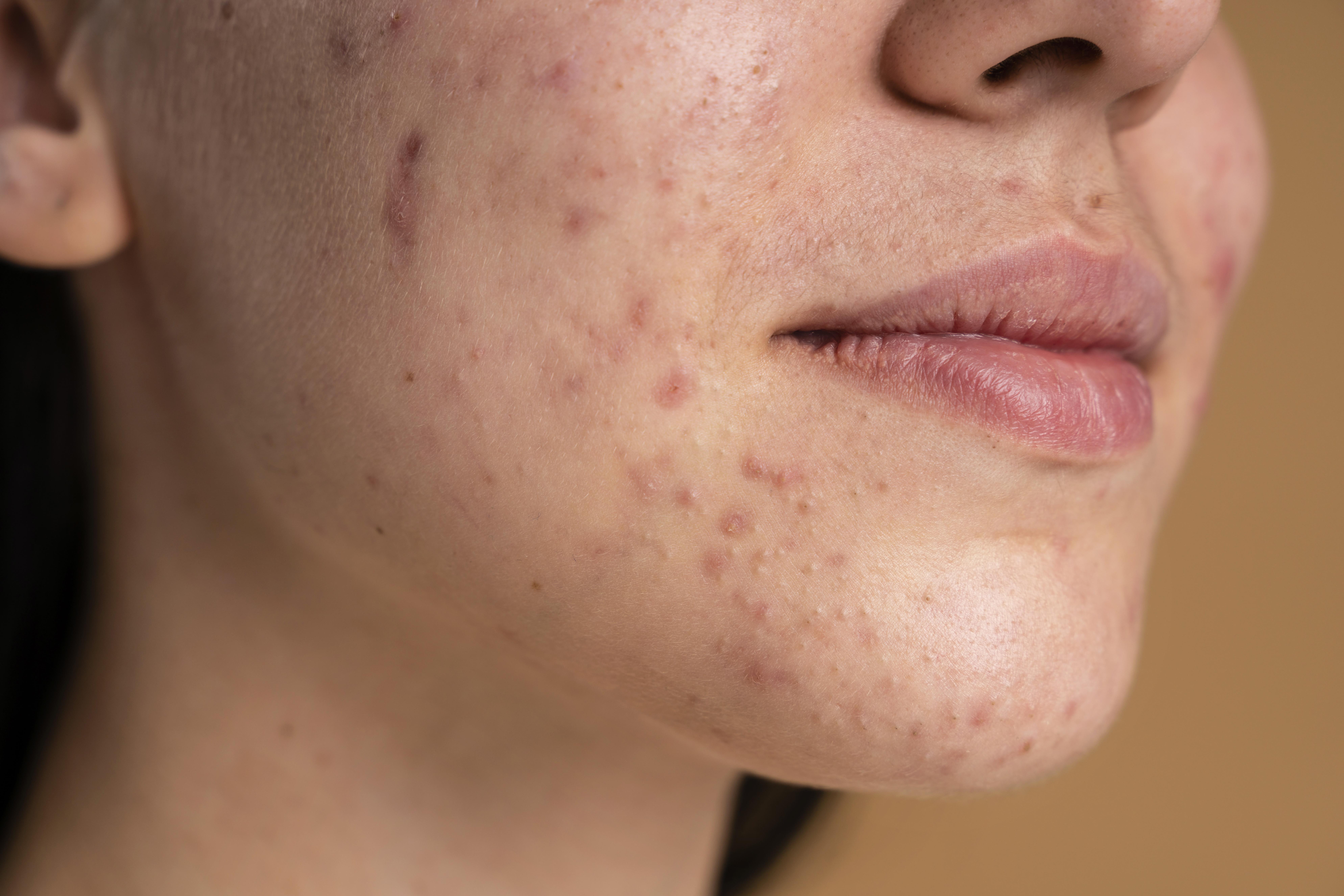 LaserMatrix Image 1